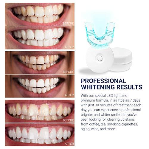 Teeth Whitening Kits - Tray (with LED light) only 